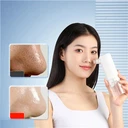 Blackhead Remover Vacuum